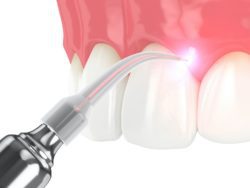 treat gum disease promptly in Rockledge Florida