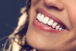 cosmetic dental treatments in Rockledge Florida