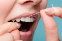 flossing tips Rockledge Florida