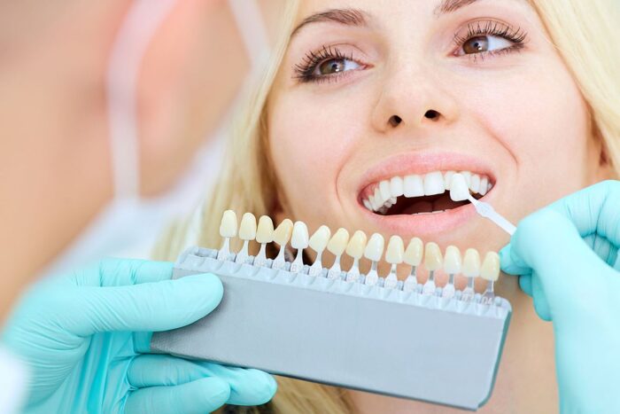 Sensitivity and Teeth Whitening