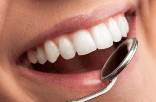 Protect Your Teeth with Bonding