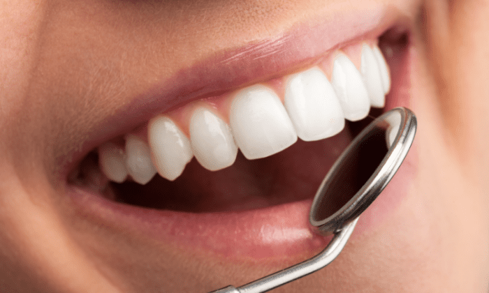 Protect Your Teeth with Bonding