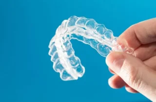 Invisalign in Viera: The Path to a Straighter Smile in Rockledge, FL